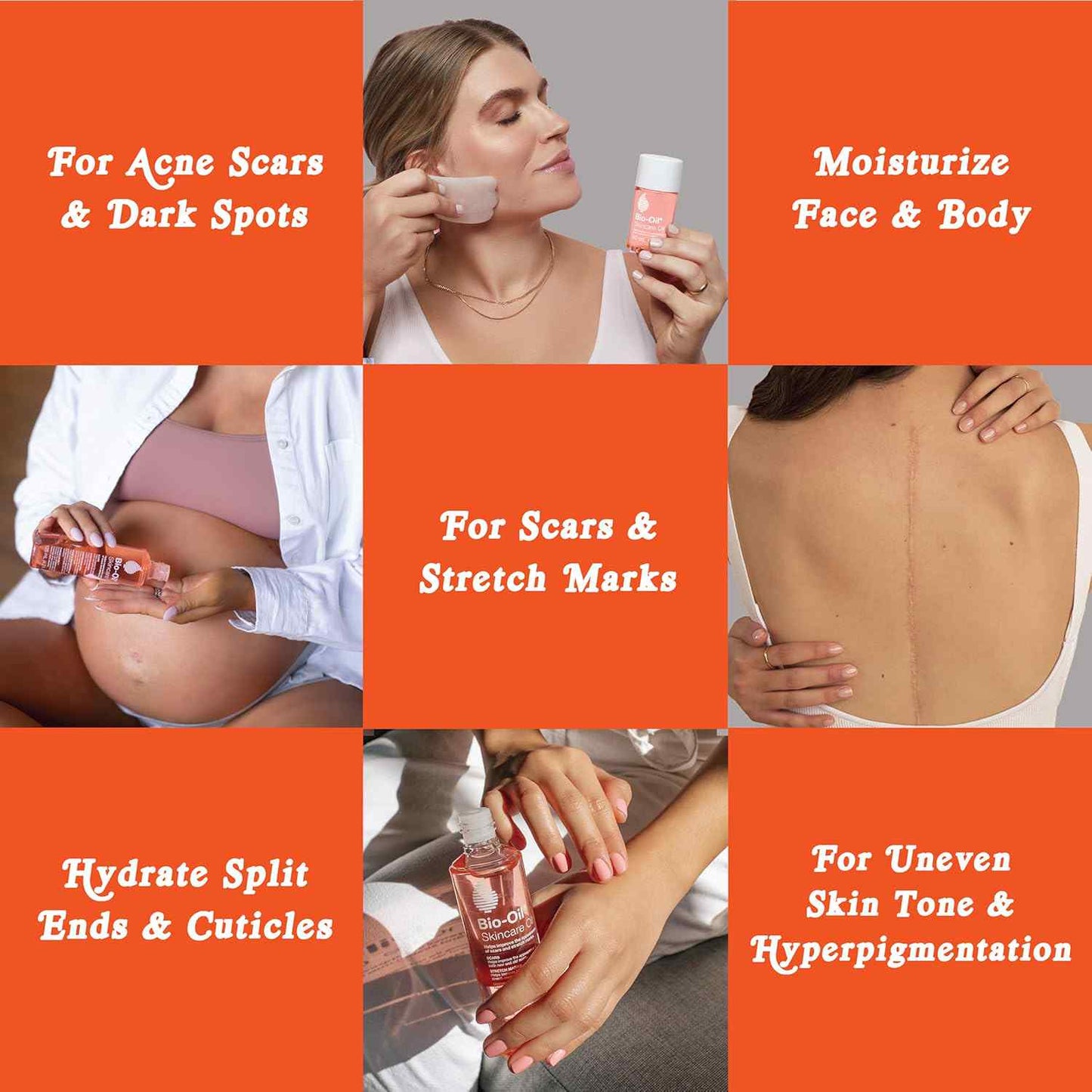 Bio-Oil Skincare Oil, 6.7 Ounce, Body Oil for Scars and Stretchmarks, Hydrates Skin, Non-Greasy