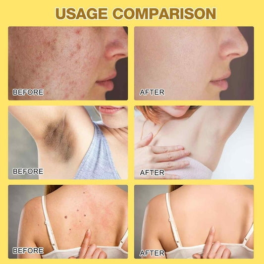 Bee Venom Skin Treatment Cream
