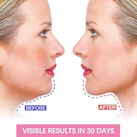 V Shape Face Slimming Strap